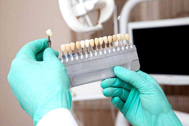 Dental Implants Benefits