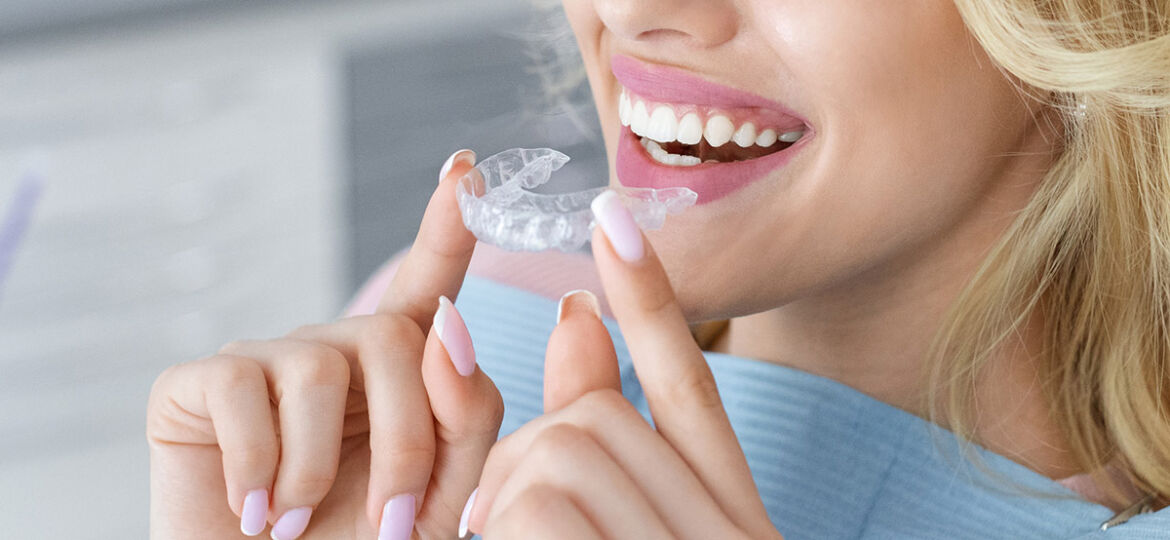 Evolution of Invisalign